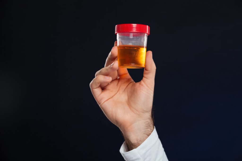 urine sample at drug rehab addiction